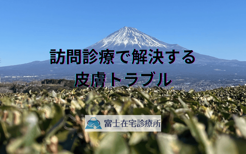 訪問診療で解決する皮膚トラブル - 自宅での適切な対処法