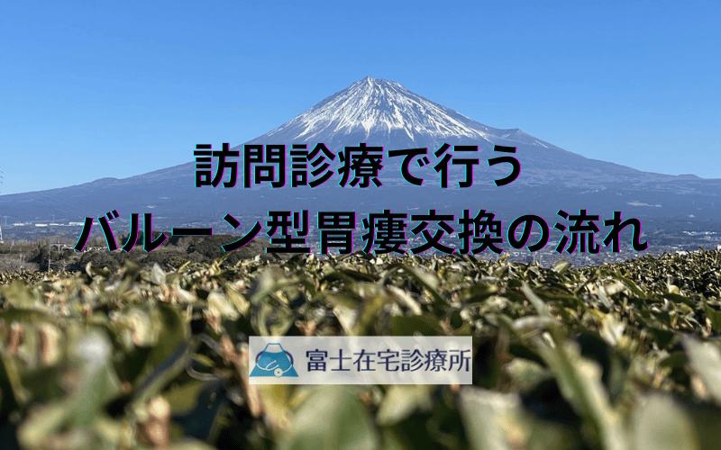 訪問診療で行うバルーン型胃瘻交換の流れ - 患者さんの負担を最小限に