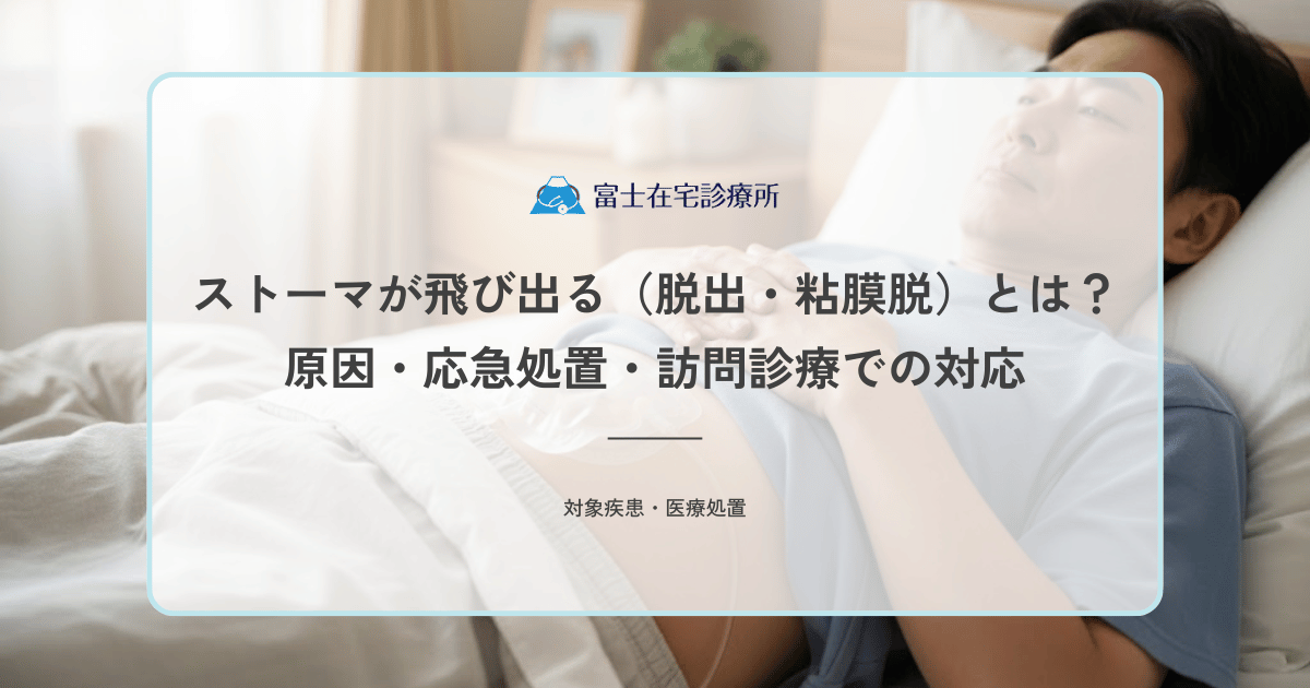 ストーマが飛び出る（脱出・粘膜脱）とは？原因・応急処置・訪問診療での対応を解説